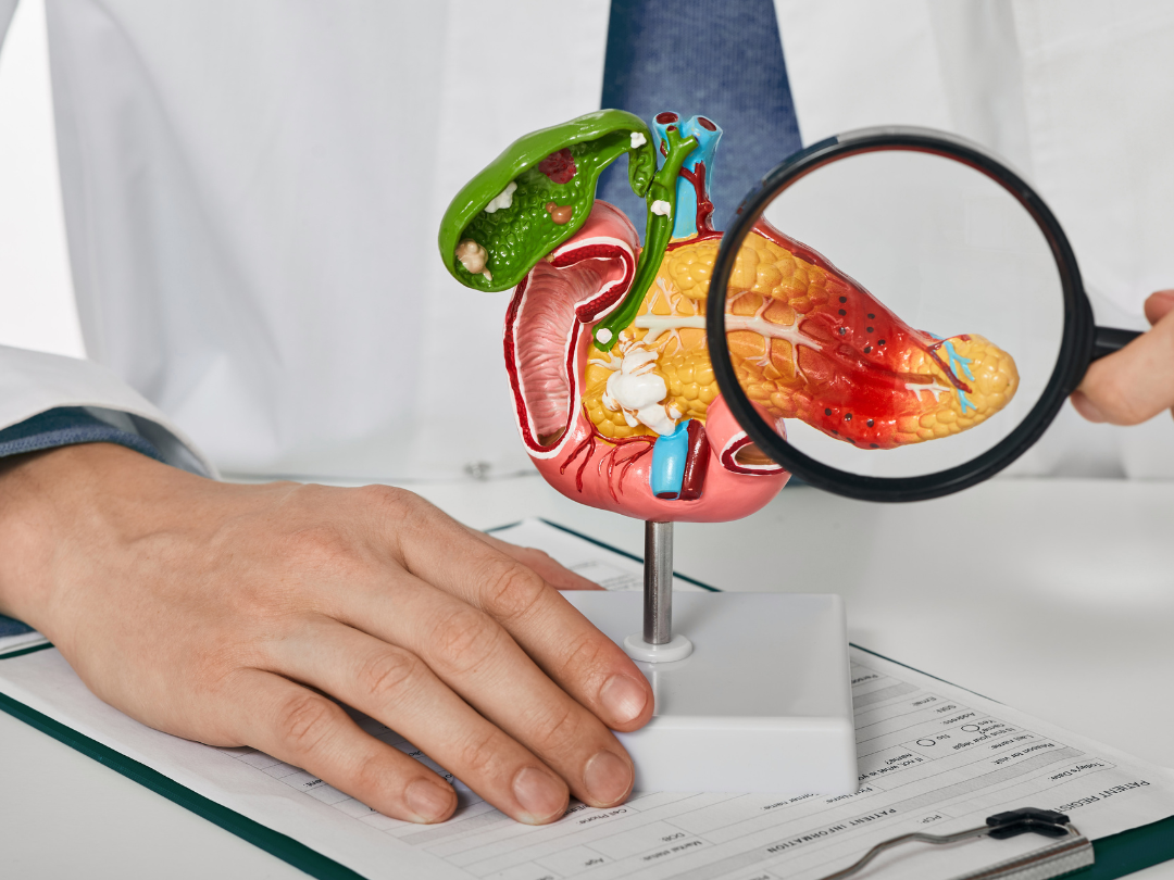 Pancreatic Diet Pancreatic Diet
