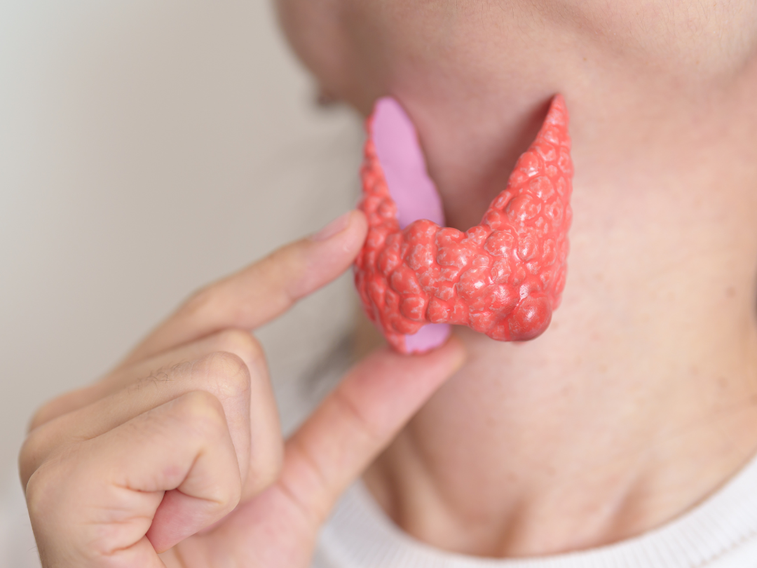 Thyroid Diet Thyroid Diet